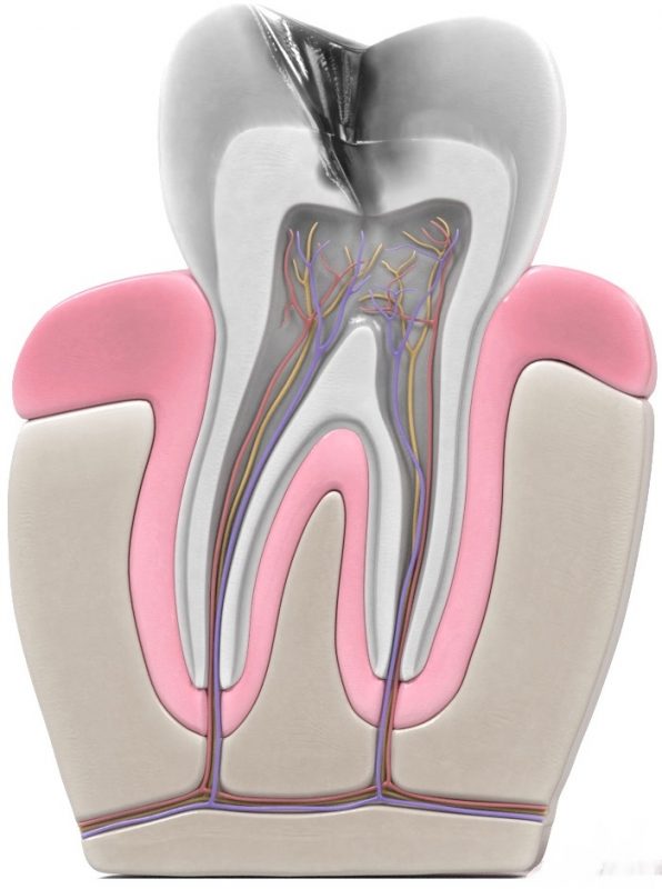 Endodoncia